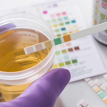 5-Panel Lab Based Drug Test