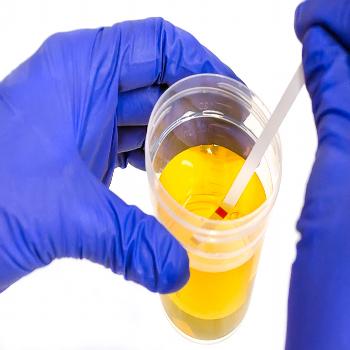 Basic Alcohol Urine Test (Ethyl)