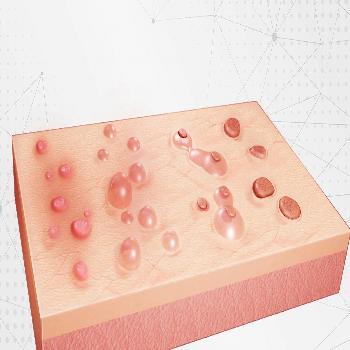 Herpes (HSV) Types 1 & 2 (Blood) Test 