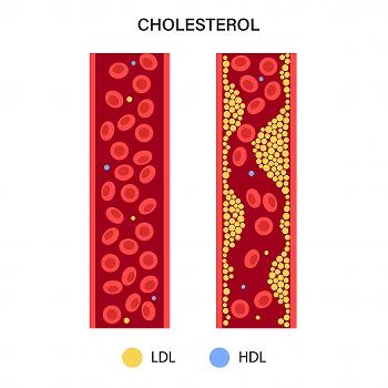 Lipid/Cholesterol Panel