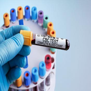 Complete Blood Count (CBC) With Differential 