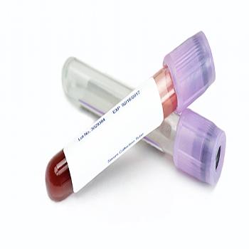 Hepatitis B Surface Antibody Quantitive Test 