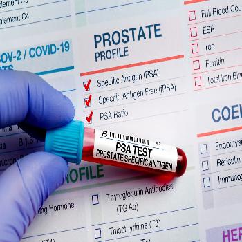 Prostate-Specific Antigen (PSA) Test