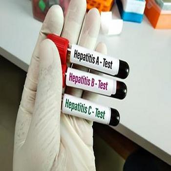Hepatitis A, B & C Test