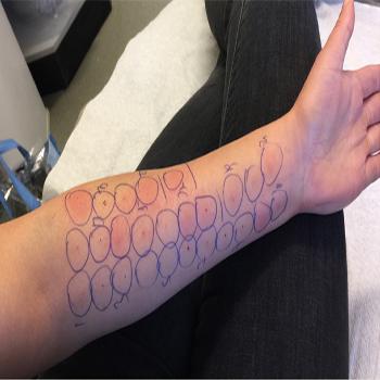 Allergy Profile / Food Allergy Test